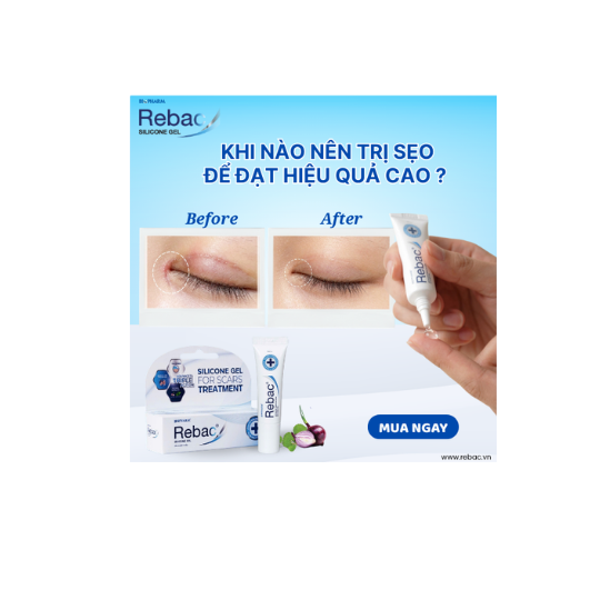 Khi nào nên trị sẹo để đạt hiệu quả cao ?