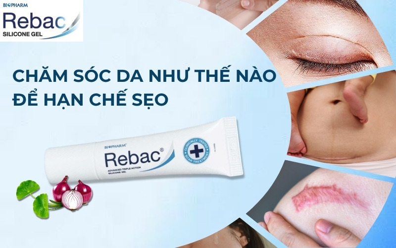  Chăm sóc da thế nào để hạn chế sẹo