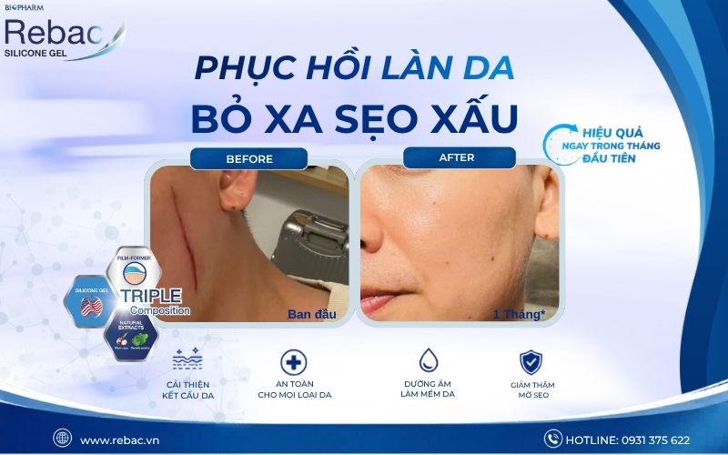 Hồi phục làn da
