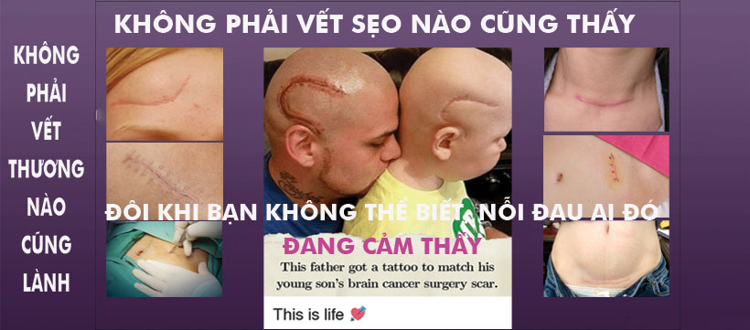 Rebac Gel Silicone công thức cải tiến hiệu quả ngay tháng đầu tiên tuýp  5g